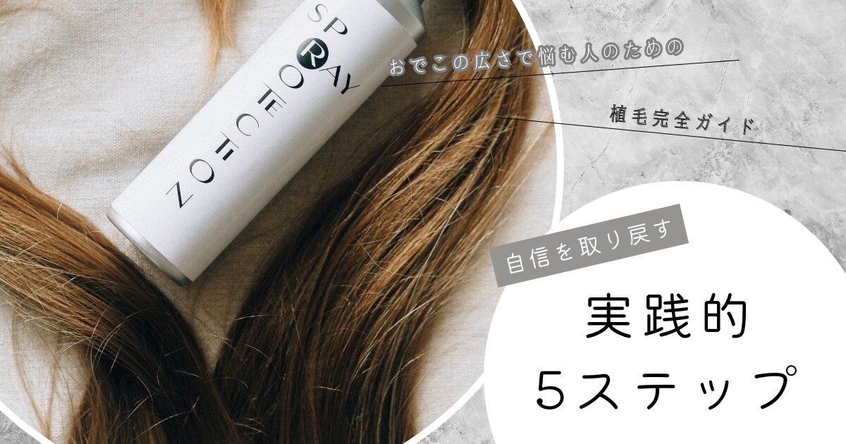 おでこの広さで悩む人のための植毛完全ガイド【自信を取り戻す実践的5ステップ】