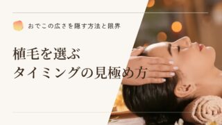 おでこの広さを隠す方法と限界｜植毛を選ぶタイミングの見極め方