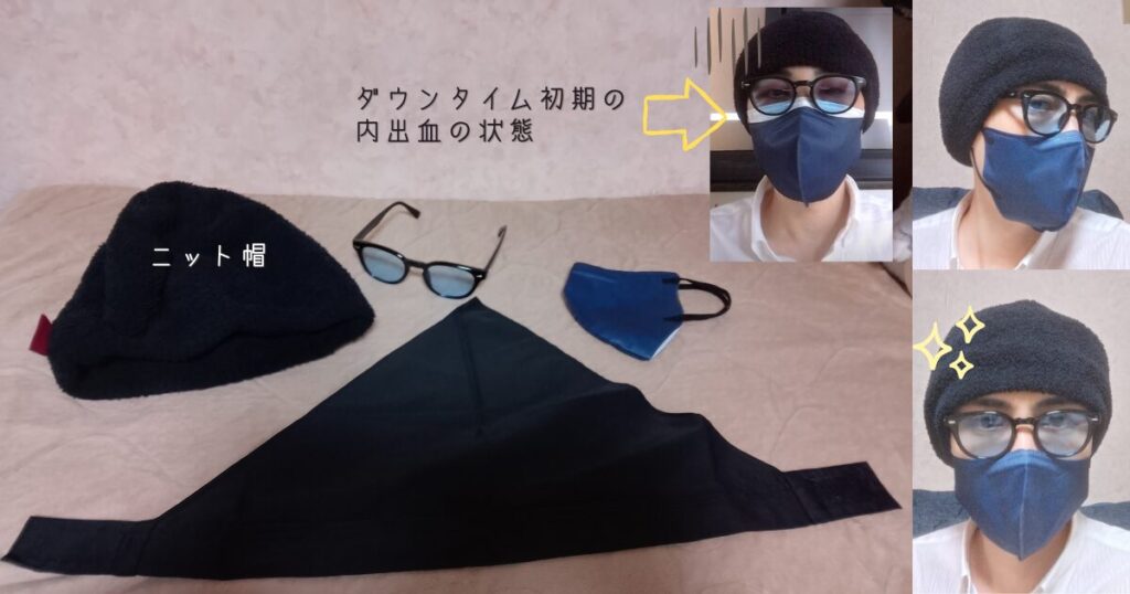 植毛のダウンタイム中、外出時に不自然さを隠すためのニット帽、サングラス、バンダナの装備一式・顔の腫れ